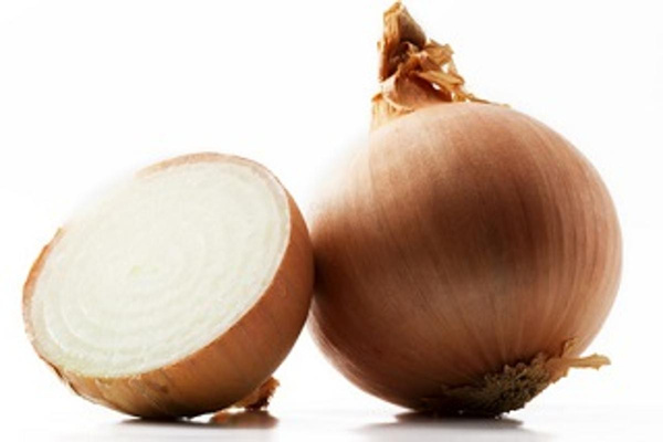 Produktfoto zu Große Küchenzwiebeln